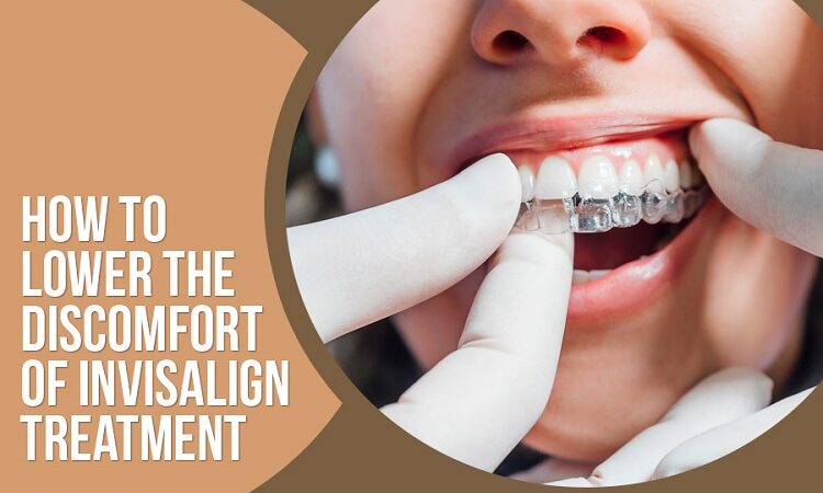 How to Lower the Discomfort of Invisalign Treatment