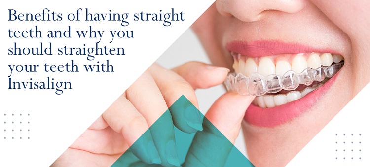 Benefits of having straight teeth and why you should straighten your teeth with Invisalign